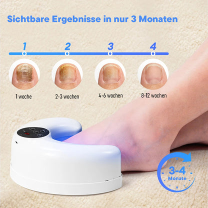 Nailclear - Anti Pilz Licht